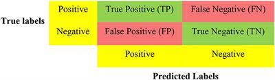 Machine learning-assisted prediction of pneumonia based on non-invasive measures